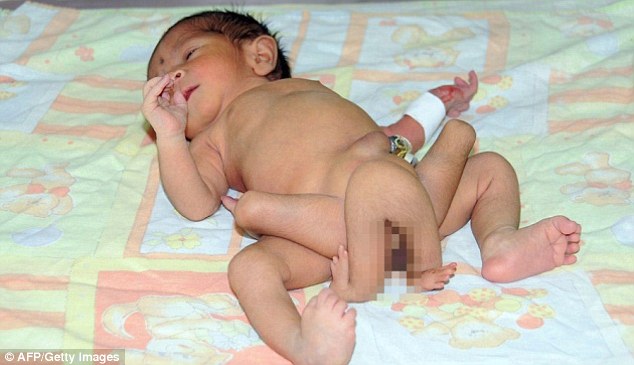 critical doctors in pakistan are fighting to save the life of the baby boy who